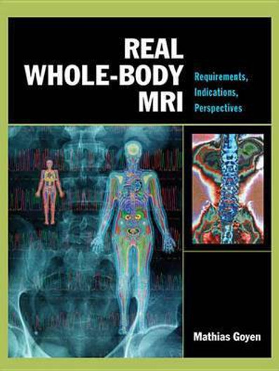 Buy Real Whole-Body MRI (English, Paperback) Online at Best Price - BookBajar