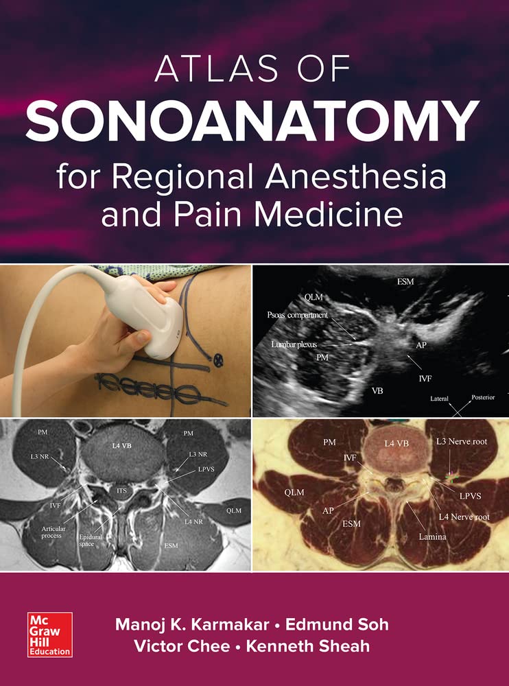 Buy Atlas of Sonoanatomy for Regional Anesthesia and Pain Medicine (English, Paperback, Manoj Karmakar) Online at Best Price - BookBajar