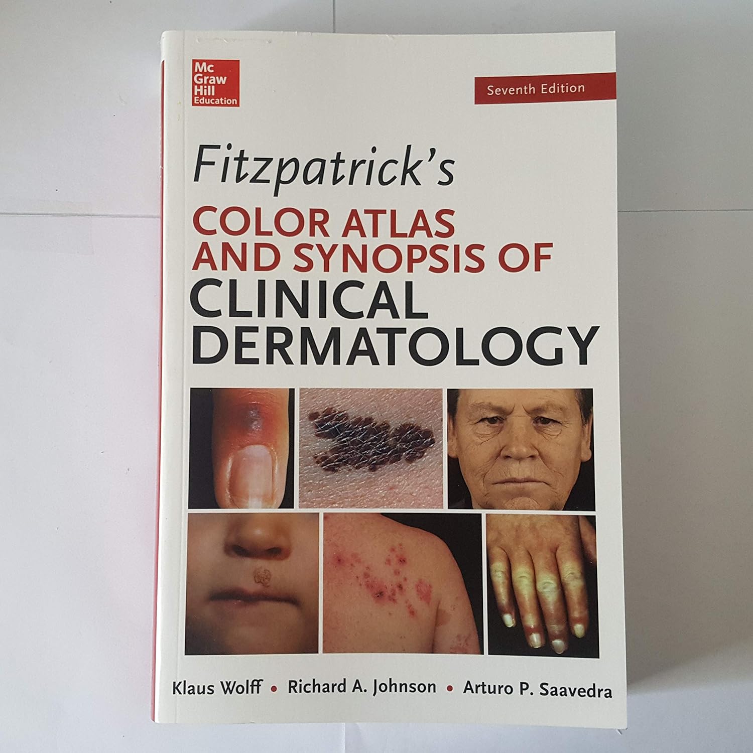 Buy Fitzpatrick's Color Atlas And Synopsis Of Clinical Dermatology (English, Paperback, Klaus Wolff, Richard Johnson, Arturo Saavedra) Online at Best Price - BookBajar