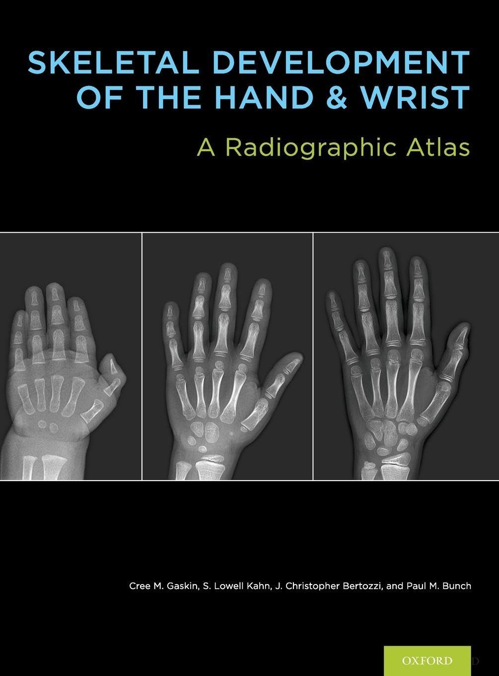 Buy Skeletal Development of the Hand and Wrist: A Radiographic Atlas and Digital Bone Age Companion (English, Paperback, M.D. Gaskin, Cree M., M.D. Kah... Online at Best Price - BookBajar
