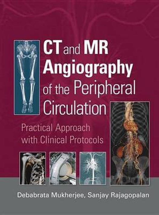 Buy CT and MR Angiography of the Peripheral Circulation (English, Paperback) Online at Best Price - BookBajar