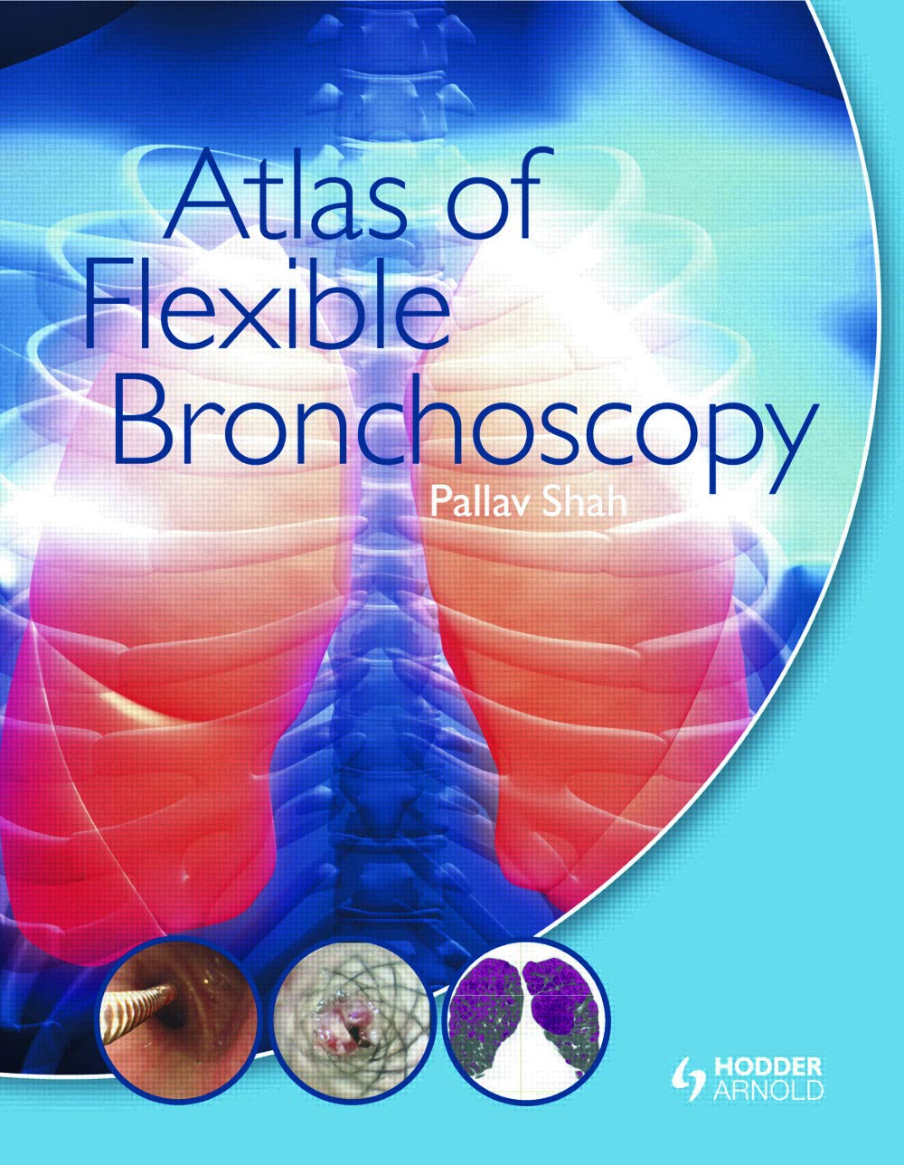 Buy Atlas OF Flexible Bronchoscopy (HB 2011) (English, Paperback, Pallav Shah) Online at Best Price - BookBajar