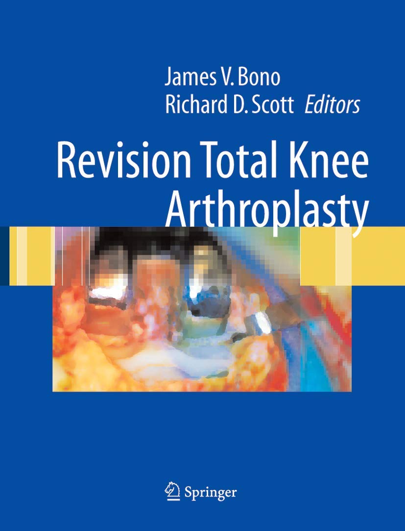 Buy Revision Total Knee Arthroplasty (English, Hardcover, Nono J.V.) Online at Best Price - BookBajar