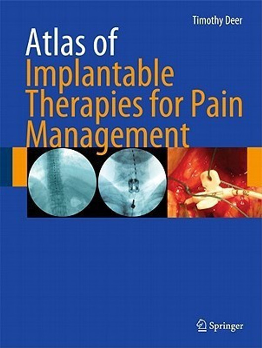 Buy Atlas of Implantable Therapies for Pain Management 1st Edition. Edition (English, Paperback) Online at Best Price - BookBajar