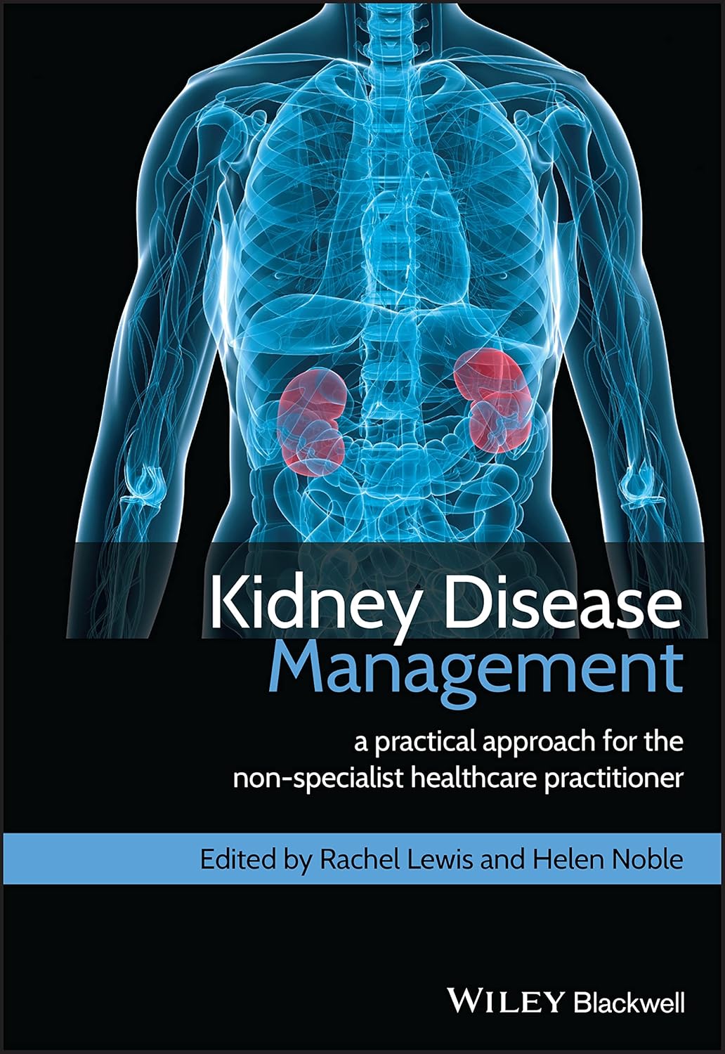 Buy Kidney Disease Management: A Practical Approach for the Non-Specialist Healthcare Practitioner (English, Paperback, Rachel Lewis, Helen Noble) Online at Best Price - BookBajar