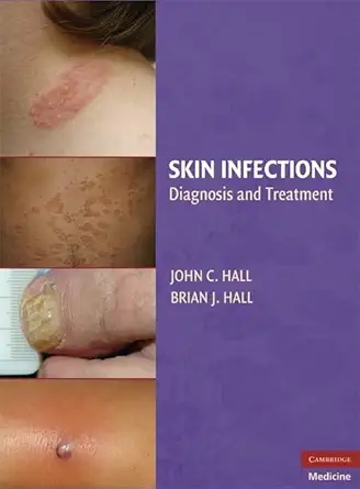 Buy Skin Infections: Diagnosis and Treatment (English, Paperback, John C. Hall MD, Brian J. Hall) Online at Best Price - BookBajar