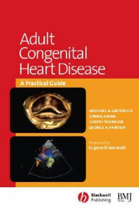 Buy Adult Congenital Heart Disease (English, Paperback) Online at Best Price - BookBajar
