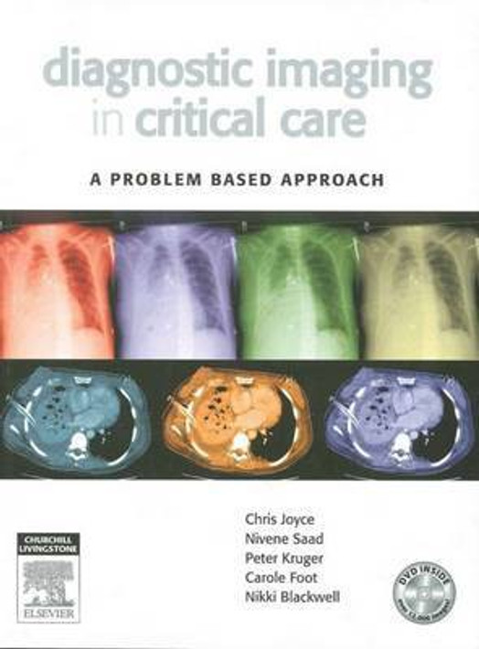 Buy Diagnostic Imaging in Critical Care - A Problem Based Approach (English, Paperback) Online at Best Price - BookBajar