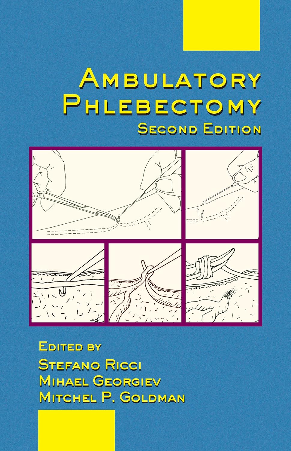 Buy Ambulatory Phlebectomy: 31 (Basic and Clinical Dermatology) (English, Paperback, Mitchel P. Goldman, Mihael Georgiev, Stefano Ricci) Online at Best Price - BookBajar