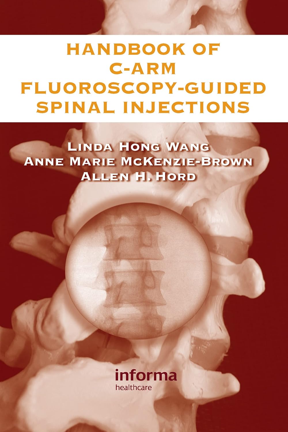 Buy Handbook Of C-Arm Fluoroscopy-Guided Spinal Injections (English, Paperback, Linda Hong Wang, Anne Marie McKenzie-Brown, Allen Hord) Online at Best Price - BookBajar