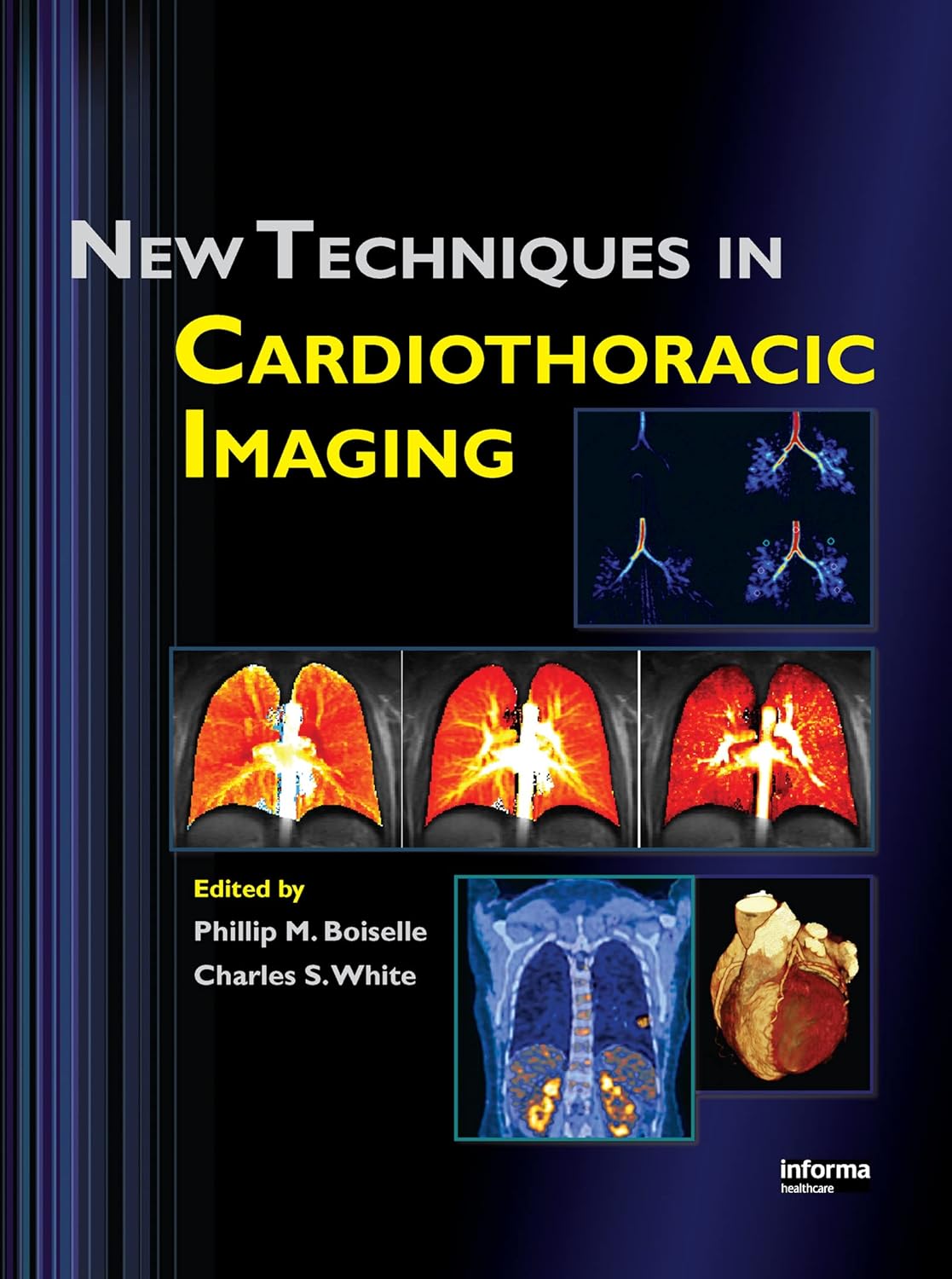 Buy New Techniques in Cardiothoracic Imaging (English, Paperback, Phillip M. Boiselle, Charles S. White) Online at Best Price - BookBajar
