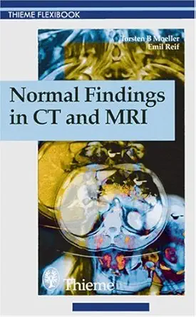 Buy Normal Findings in Ct and Mri (Thieme Flexibook) (English, Paperback, Torsten Moeller, Emil Reif) Online at Best Price - BookBajar
