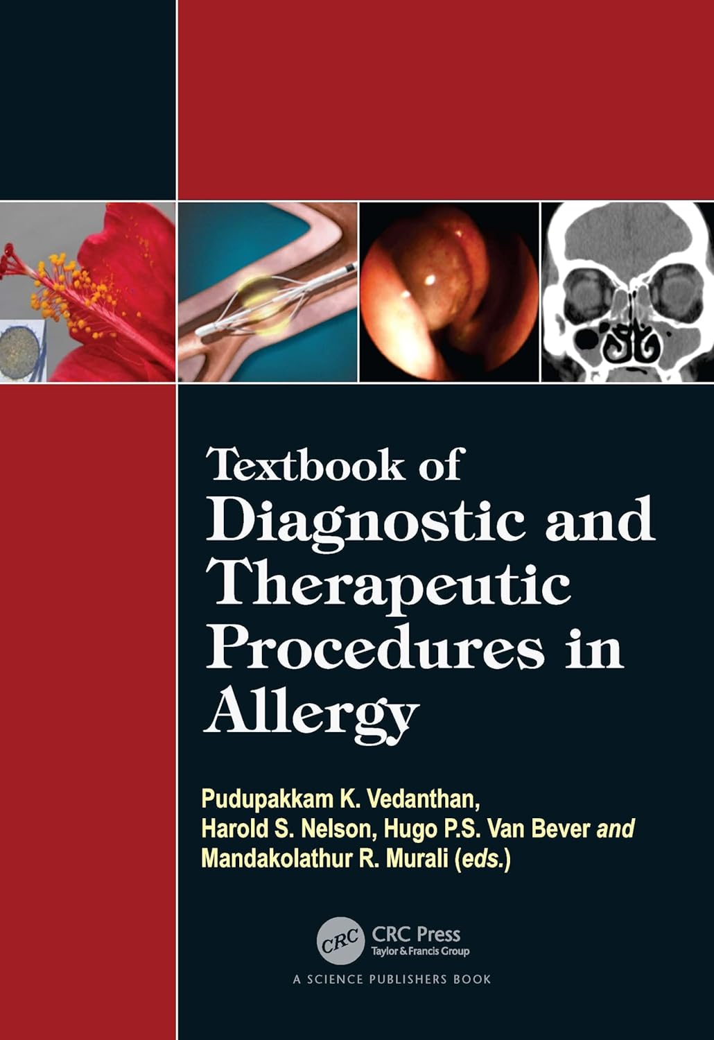 Buy Textbook of Diagnostic and Therapeutic Procedures in Allergy (English, Paperback, Pudupakkam K. Vedanthan, Harold S. Nelson, Hugo Van Bever, Mandak... Online at Best Price - BookBajar