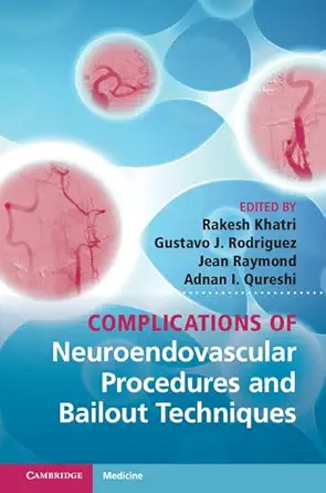 Buy Complications of Neuroendovascular Procedures and Bailout Techniques (English, Paperback, Rakesh Khatri, Gustavo J. Rodriguez, Jean Raymond, Adnan ... Online at Best Price - BookBajar