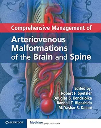 Buy Comprehensive Management of Arteriovenous Malformations of the Brain and Spine (English, Paperback, Robert F. Spetzler, Douglas S. Kondziolka, Rand... Online at Best Price - BookBajar