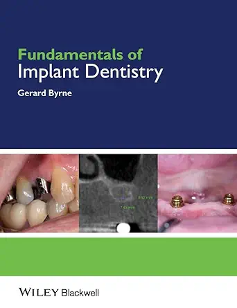 Buy Fundamentals of Implant Dentistry (English, Paperback, Gerard Byrne) Online at Best Price - BookBajar