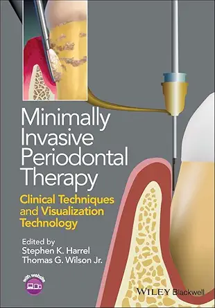 Buy Minimally Invasive Periodontal Therapy: Clinical Techniques and Visualization Technology (English, Paperback, Stephen K. Harrel, Thomas G. Wilson Jr.) Online at Best Price - BookBajar