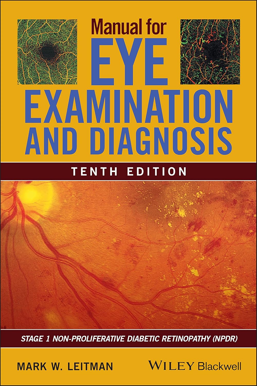 Buy Manual for Eye Examination and Diagnosis (English, Paperback, Mark W. Leitman) Online at Best Price - BookBajar