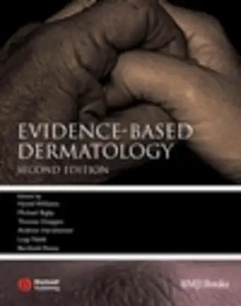Buy Evidence–Based Dermatology (Evidence–Based Medicine) (English, Hardcover, Hywel Williams, Michael Bigby, Thomas Diepgen, Andrew Herxheimer, Luigi N... Online at Best Price - BookBajar