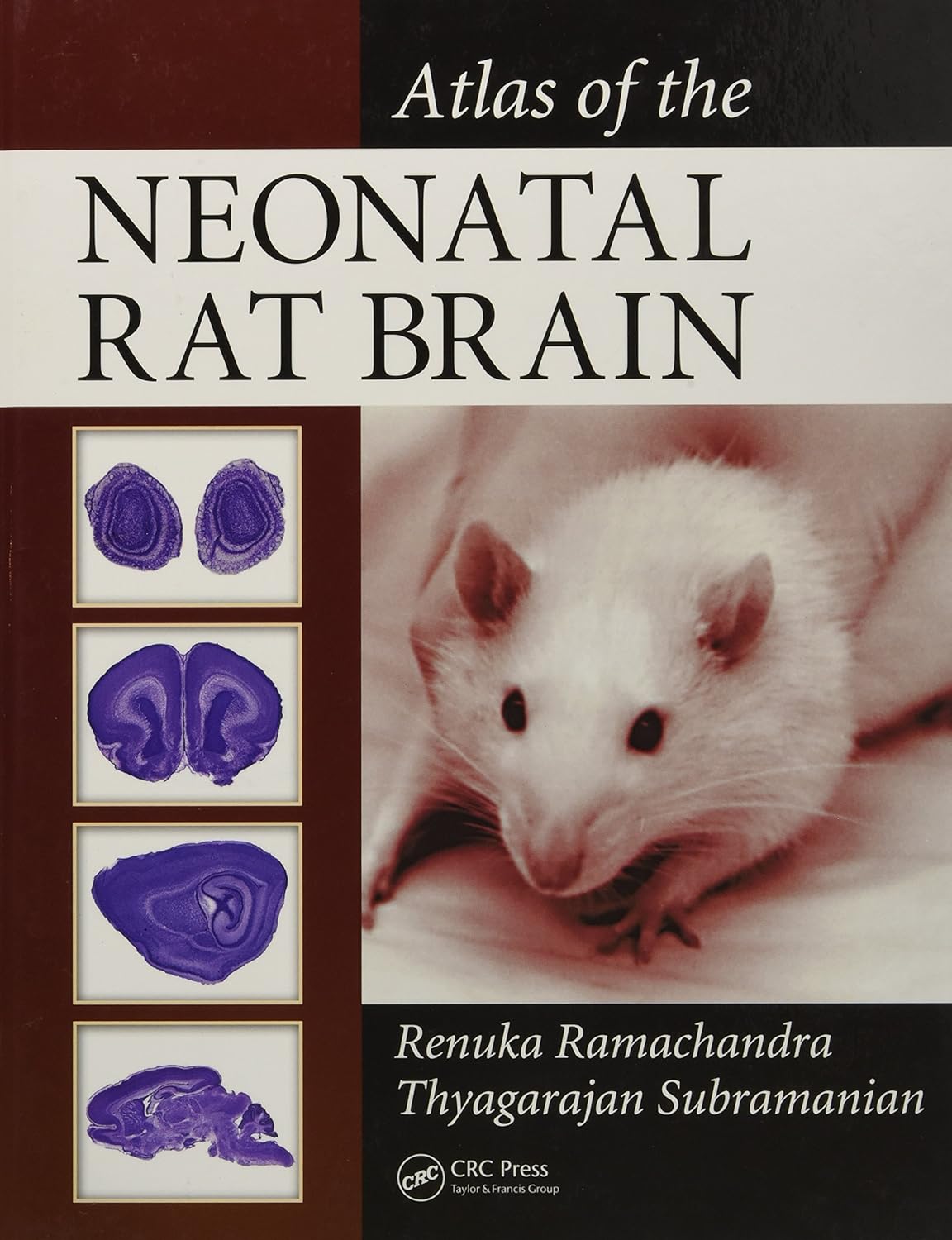 Buy Atlas of the Neonatal Rat Brain (English, Paperback, Renuka Ramachandra, Thyagarajan Subramanian) Online at Best Price - BookBajar