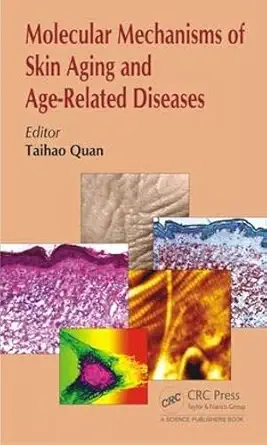 Buy Molecular Mechanisms of Skin Aging and Age-Related Diseases (English, Hardcover) Online at Best Price - BookBajar