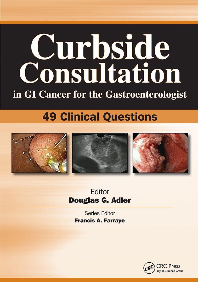 Buy Curbside Consultation in GI Cancer for the Gastroenterologist: 49 Clinical Questions (Curbside Consultation in Gastroenterology) (English, Paperbac... Online at Best Price - BookBajar