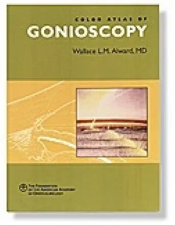 Buy New Color Atlas of Gonioscopy (English, Paperback, Laura Wallace, M. Alward) Online at Best Price - BookBajar
