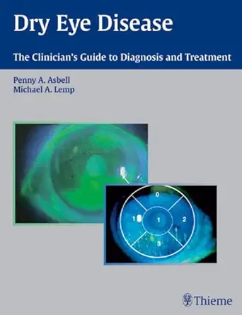 Buy Dry Eye Disease: The Clinician's Guide to Diagnosis and Treatment (English, Paperback, Penny A. Asbell) Online at Best Price - BookBajar