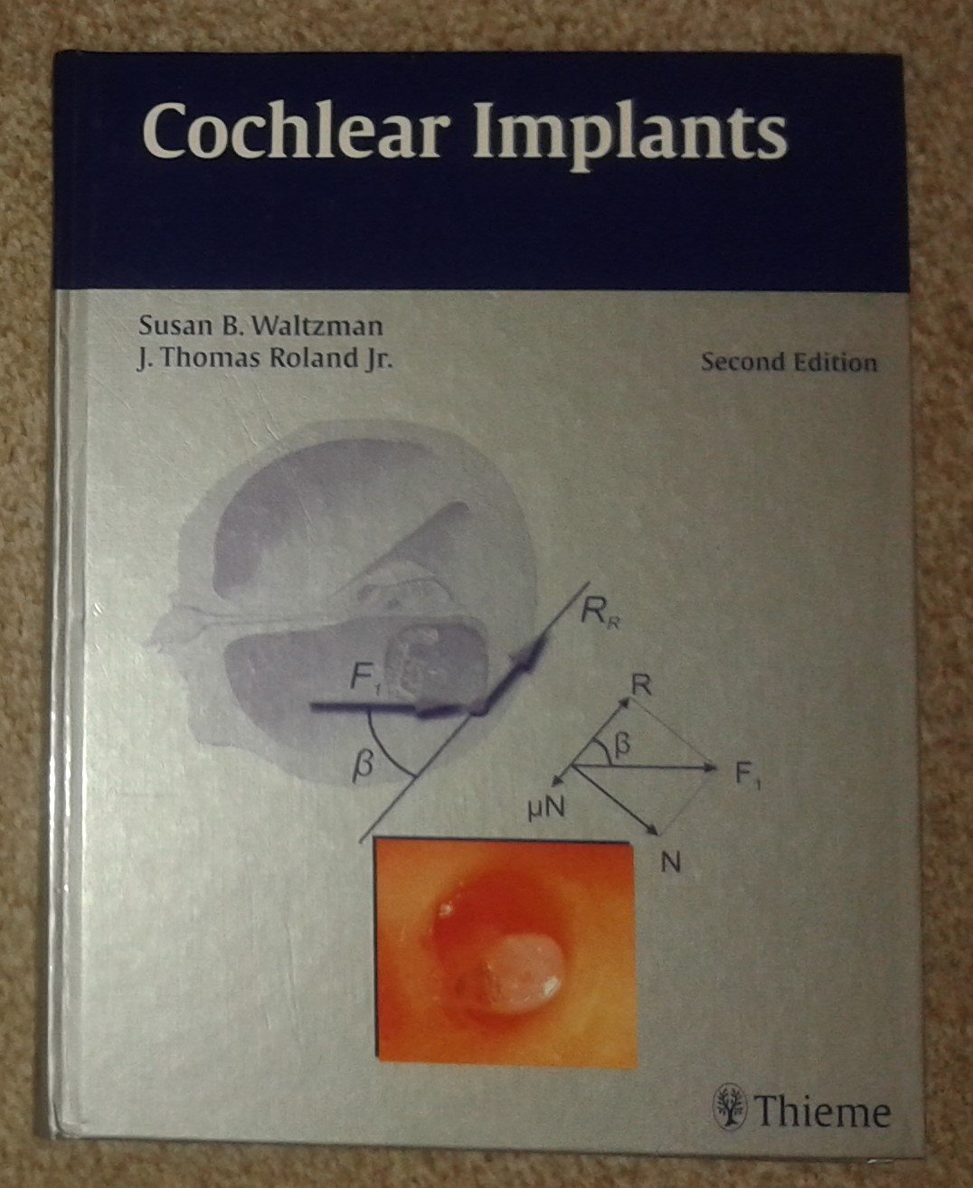 Buy Cochlear Implants (English, Hardcover, Susan B Waltzman, J Thomas Roland Jr.) Online at Best Price - BookBajar
