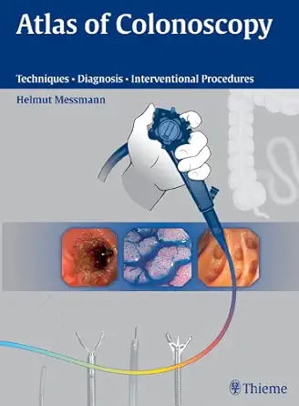 Buy Atlas of Colonoscopy: Techniques, Diagnosis, Interventional Procedures (English, Paperback, Jurgen Barnert, Max Bittinger, Thomas Eberl, M.D. Messm... Online at Best Price - BookBajar