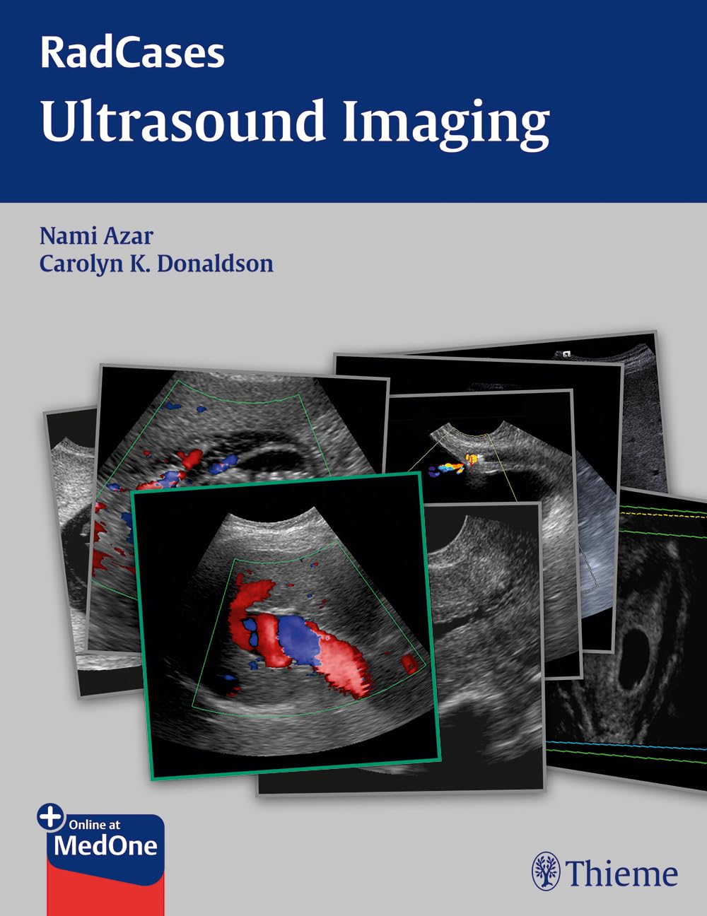 Buy Radcases Ultrasound Imaging (English, Paperback, Nami R. Azar) Online at Best Price - BookBajar