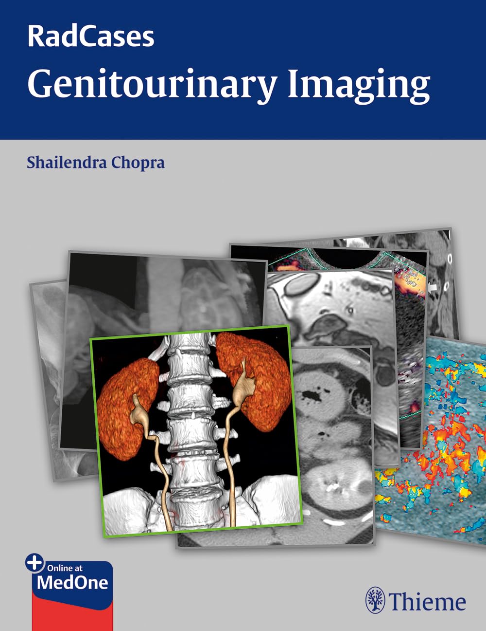 Buy Genitourinary Imaging: RadCases (English, Paperback, Shailendra Chopra) Online at Best Price - BookBajar