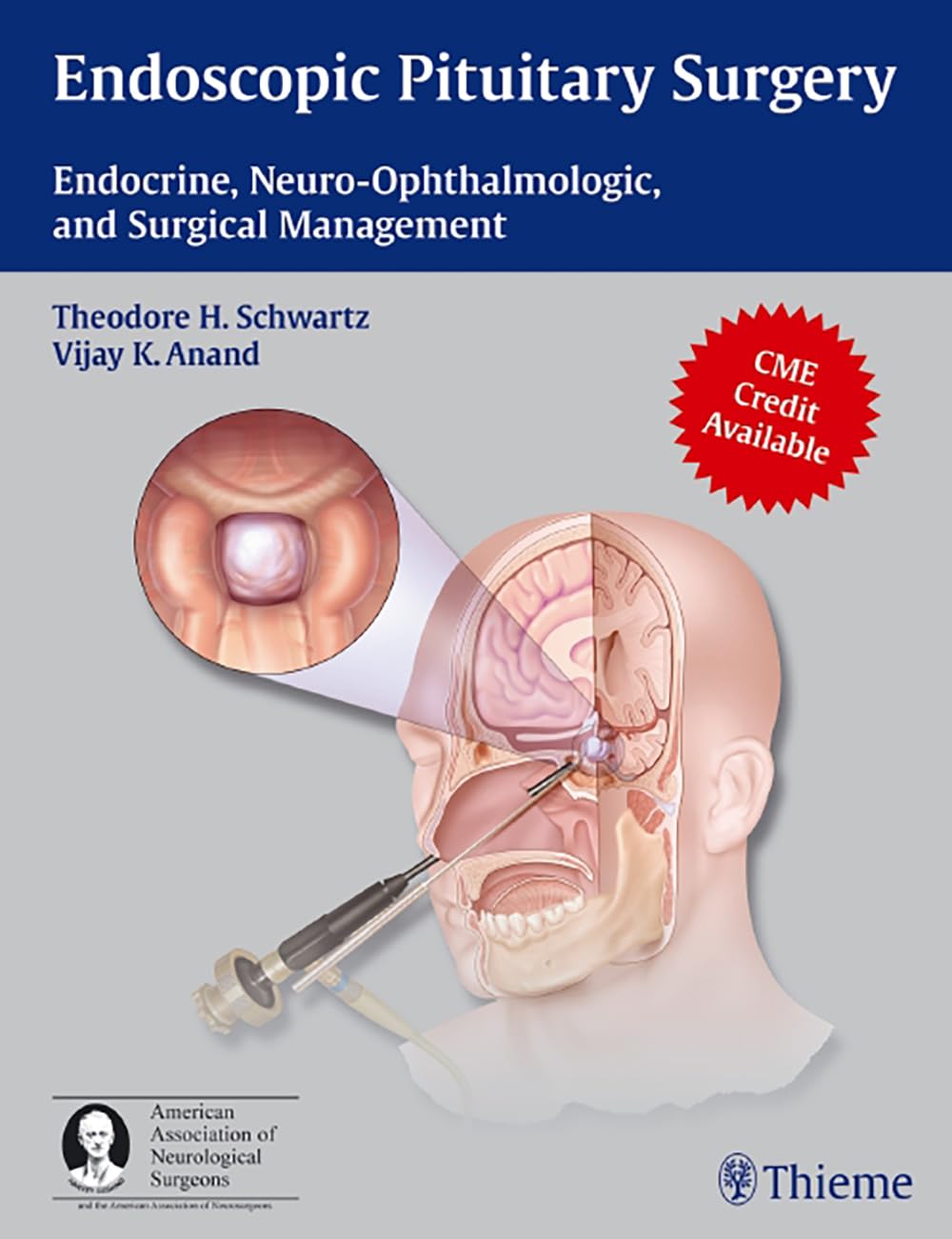 Buy Endoscopic Pituitary Surgery: Endocrine, Neuro-Ophthalmologic and Surgical Management (English, Paperback, Theodore H. Schwartz) Online at Best Price - BookBajar