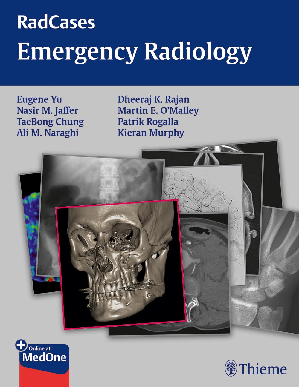 Buy Radcases Emergency Radiology (English, Paperback, Yu, Jaffer, Chung, Naraghi, Rajan, Murphy) Online at Best Price - BookBajar