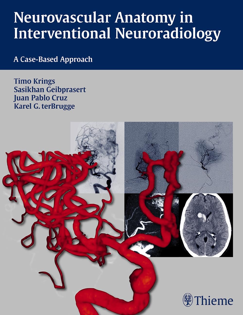 Buy Neurovascular Anatomy in Interventional Neuroradiology (English, Paperback, Timo Krings) Online at Best Price - BookBajar
