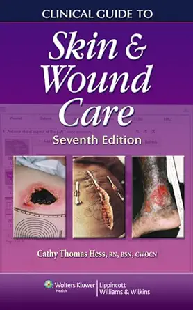 Buy Clinical Guide to Skin and Wound Care (English, Paperback, Cathy Thomas Hess RN BSN CWCN) Online at Best Price - BookBajar