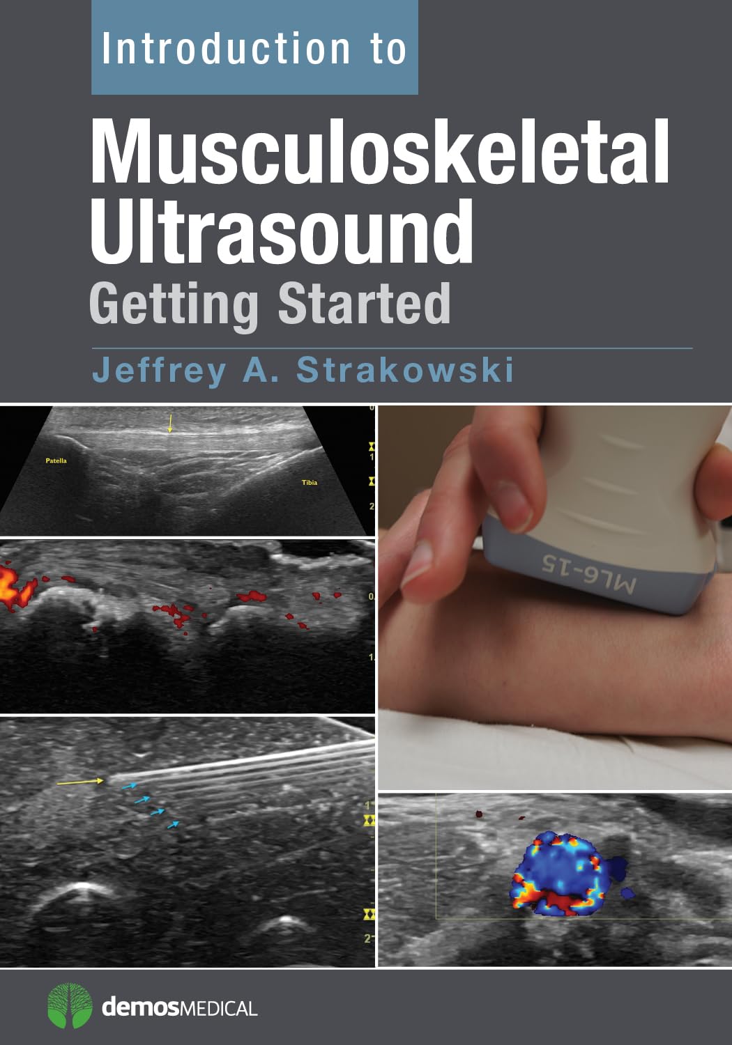 Buy Introduction to Musculoskeletal Ultrasound: Getting Started (English, Paperback, M.D. Strakowski, Jeffrey A.) Online at Best Price - BookBajar