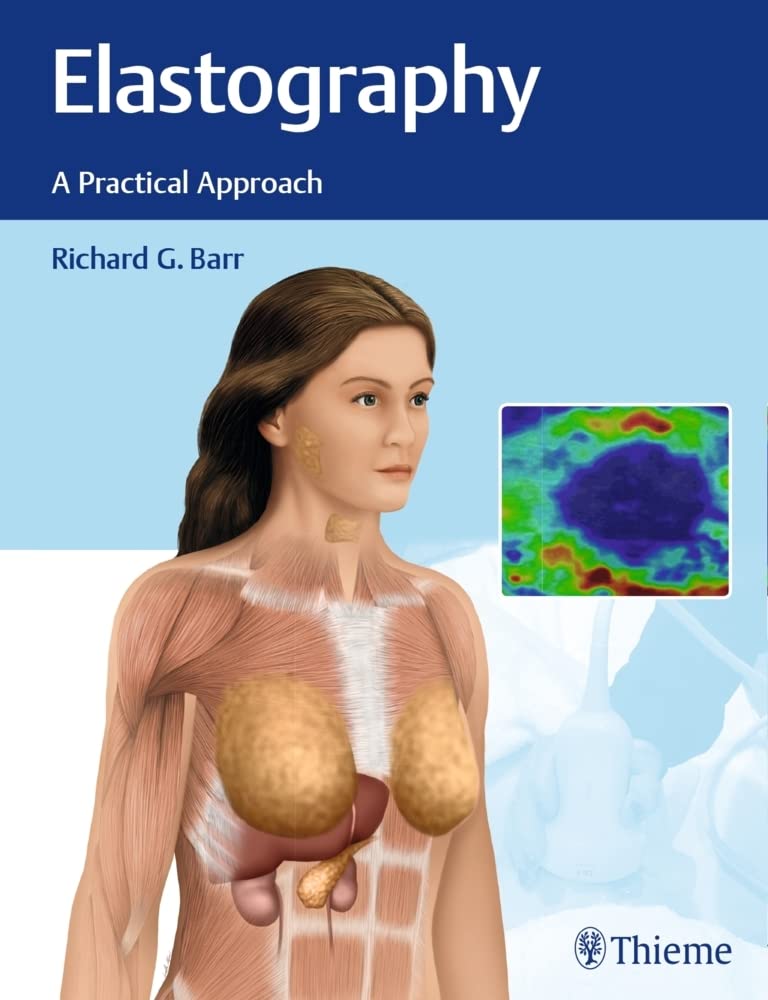 Buy Elastography: A Practical Approach (English, Paperback, Barr) Online at Best Price - BookBajar