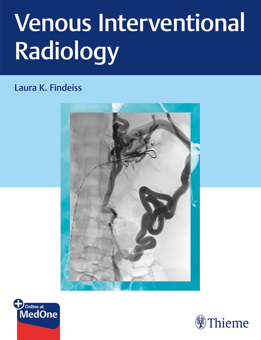 Buy Venous Interventional Radiology (English, Paperback, Laura K. Findeiss) Online at Best Price - BookBajar