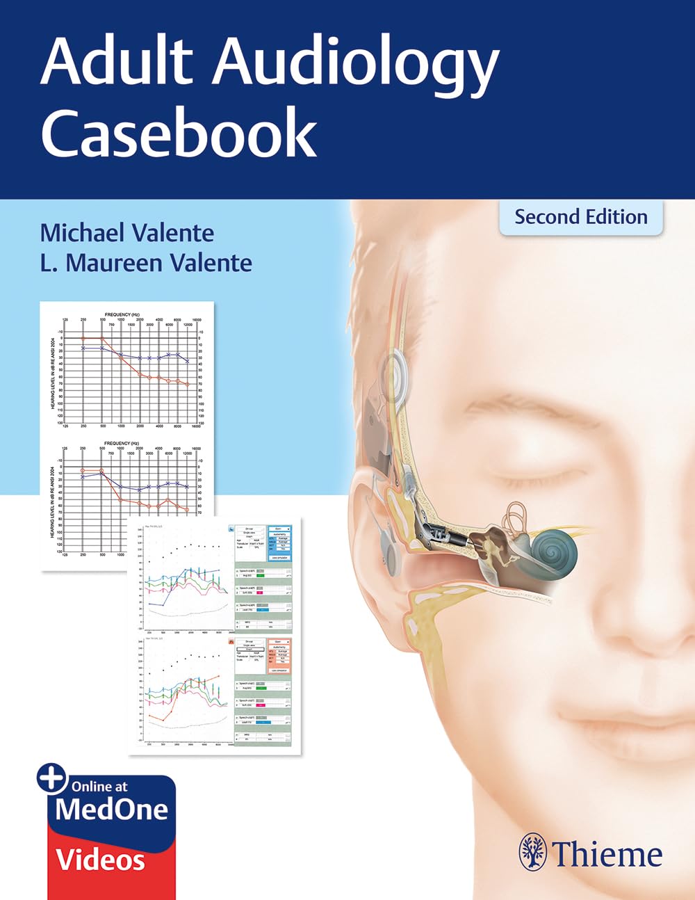 Buy Adult Audiology CasPaperback (English, Paperback, Valente) Online at Best Price - BookBajar