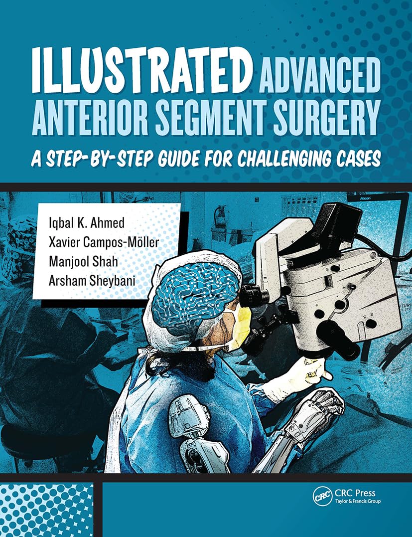 Buy Illustrated Advanced Anterior Segment Surgery: A Step-by-Step Guide for Challenging Cases (English, Paperback, Iqbal Ahmed, Xavier Möller, Manjool ... Online at Best Price - BookBajar