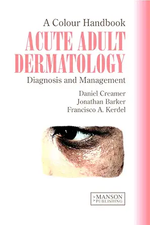 Buy Acute Adult Dermatology: Diagnosis and Management: Diagnosis and Management: A Colour Handbook (English, Paperback, Daniel Creamer, Jonathan Barker... Online at Best Price - BookBajar