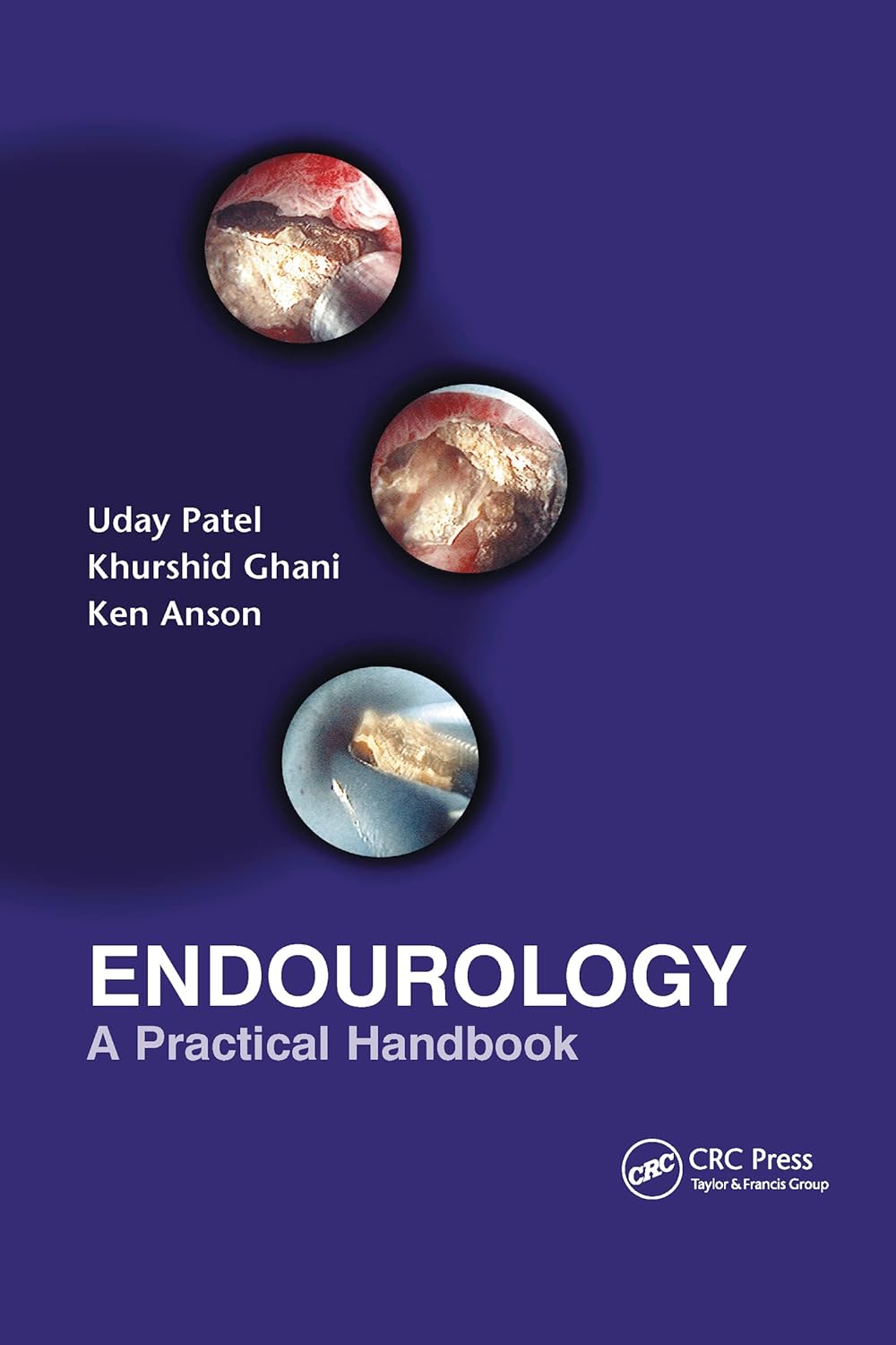 Buy Endourology: A Practical Handbook (English, Hardcover, Uday Patel, Kenneth M. Anson, Khurshid Ghani) Online at Best Price - BookBajar