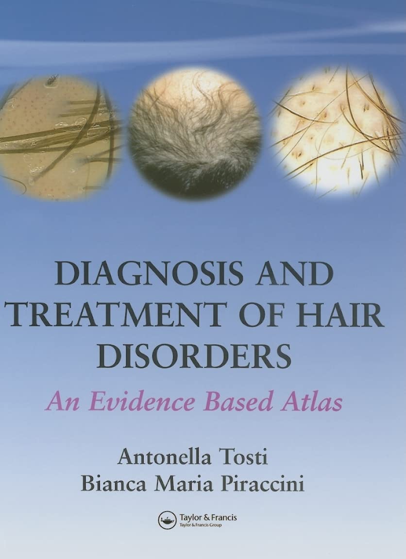 Buy Diagnosis And Treatment Of Hair Disorders: An Evidence Based Atlas (English, Paperback, Antonella Tosti, Bianca Maria Piraccini) Online at Best Price - BookBajar