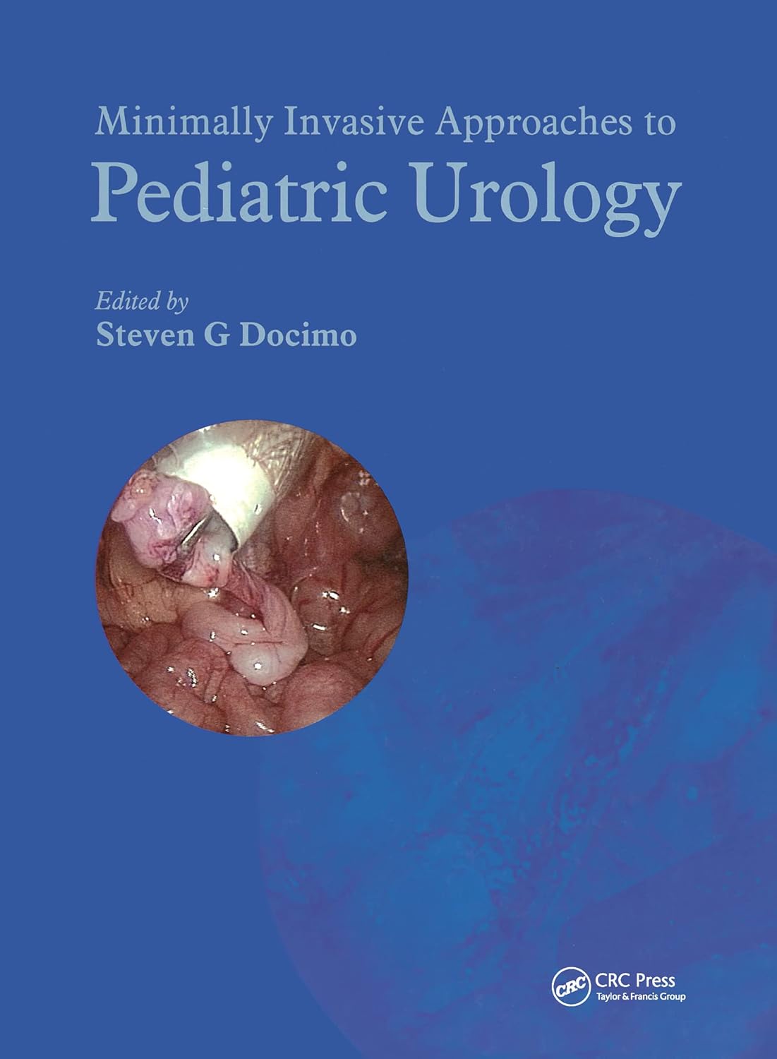 Buy Minimally Invasive Approaches To Pediatric Urology (English, Hardcover, Steven G. Docimo) Online at Best Price - BookBajar