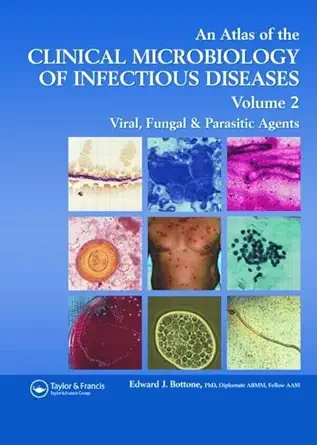 Buy AN ATLAS OF CLINICAL MICROBIOLOGY OF INFECTIOUS DISEASES VOL.2: Viral, Fungal, and Parasitic Agents (Encyclopedia of Visual Medicine Series) (Engli... Online at Best Price - BookBajar