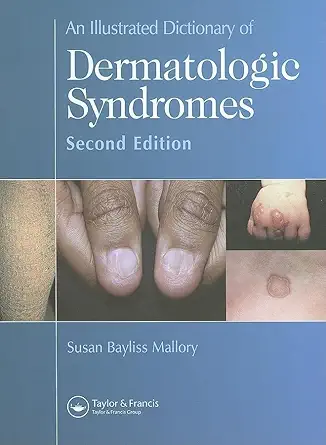 Buy AN Illustrated Dictionary OF Dermatologic Syndromes 2/E (English, Paperback, Susan B. Mallory) Online at Best Price - BookBajar