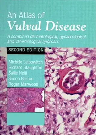 Buy An Atlas of Vulval Disease: A Combined Dermatological, Gynaecological and Venereological Approach (English, Hardcover, Michèle Leibowitch, Richard ... Online at Best Price - BookBajar