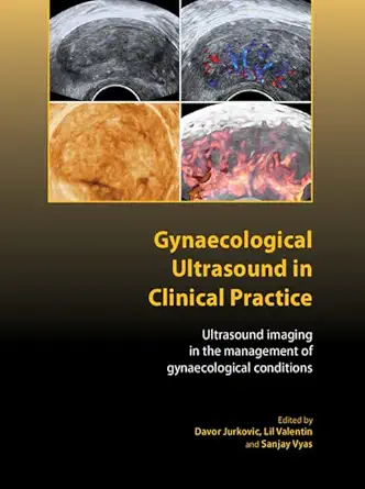 Buy Gynaecological Ultrasound in Clinical Practice: Ultrasound Imaging in the Management of Gynaecological Conditions (Royal College of Obstetricians a... Online at Best Price - BookBajar
