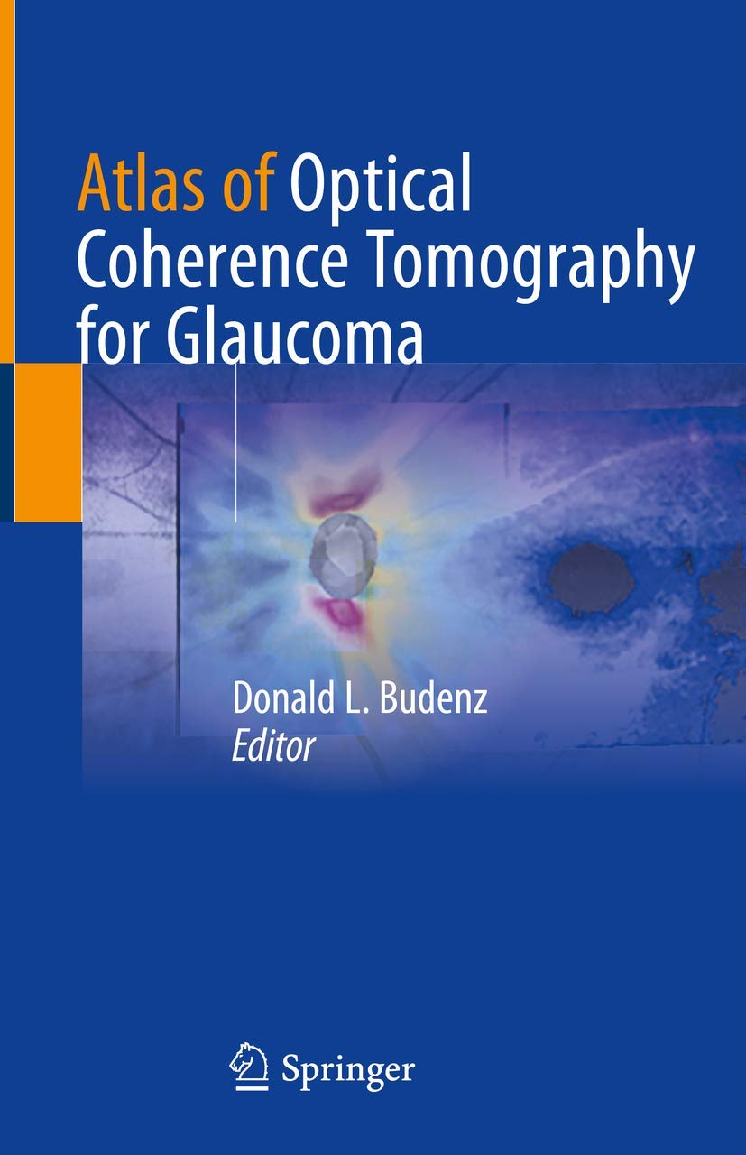 Buy Atlas OF Optical Coherence Tomography FOR Glaucoma (HB 2020) (English, Paperback, Budenz D.L.) Online at Best Price - BookBajar